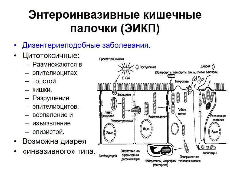 Энтероинвазивные кишечные палочки (ЭИКП) Дизентериеподобные заболевания. Цитотоксичные:  Размножаются в  эпителиоцитах  толстой